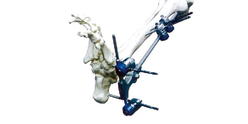 KT-5170