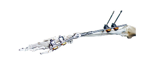 KT-5160